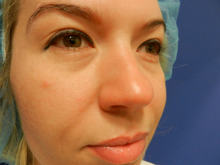 Before Image: Patient # 10257 - 