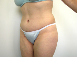 After Image: Patient # 41580 - 