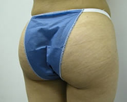 After Image: Patient # 56076 - 