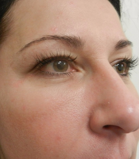 After Image: Patient # 66548 - 