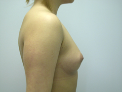 Before Image: Patient # 27850