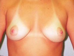 Before Image: Patient # 77447