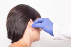 Otoplasty Chicago IL