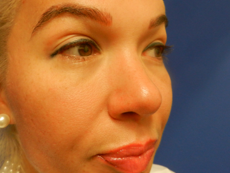 After Image: Patient # 10257 - 